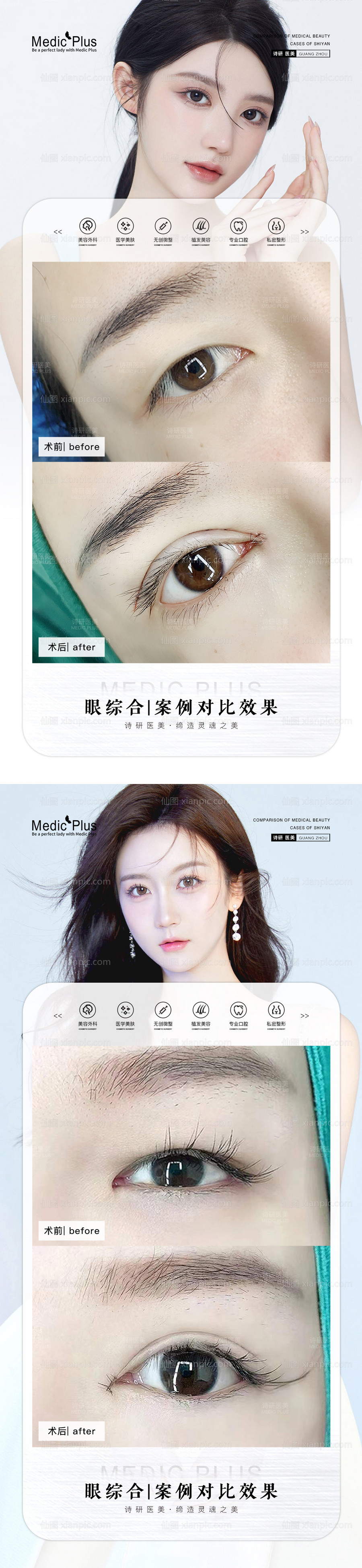 素材乐-医美眼综合案例海报