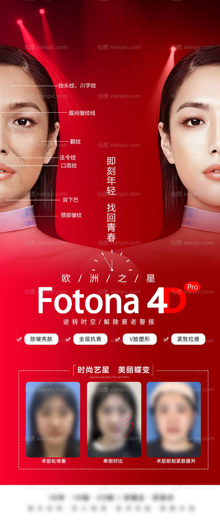 素材乐-医美美容F4Fotona4D 