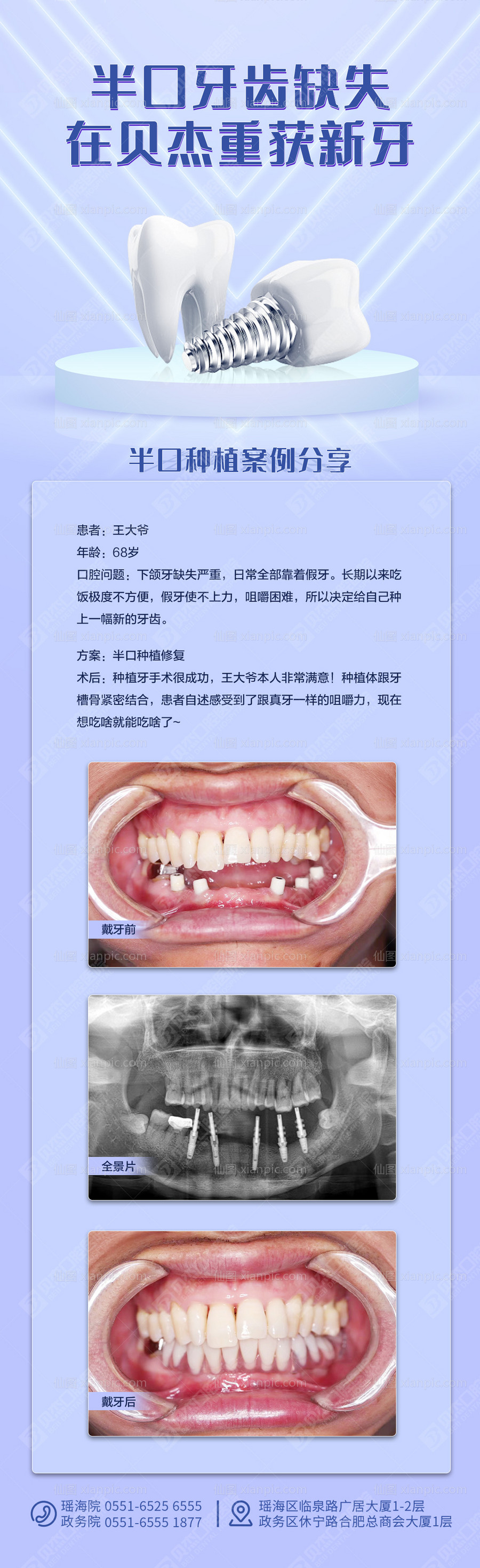 仙图网-口腔半口缺失案例