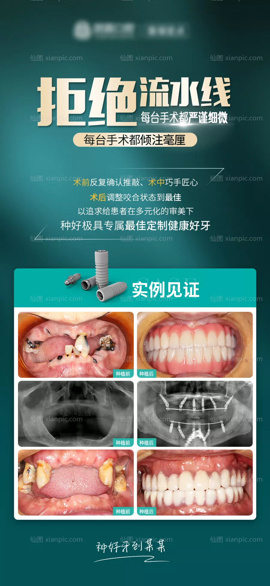 仙图网-口腔种植朋友圈海报