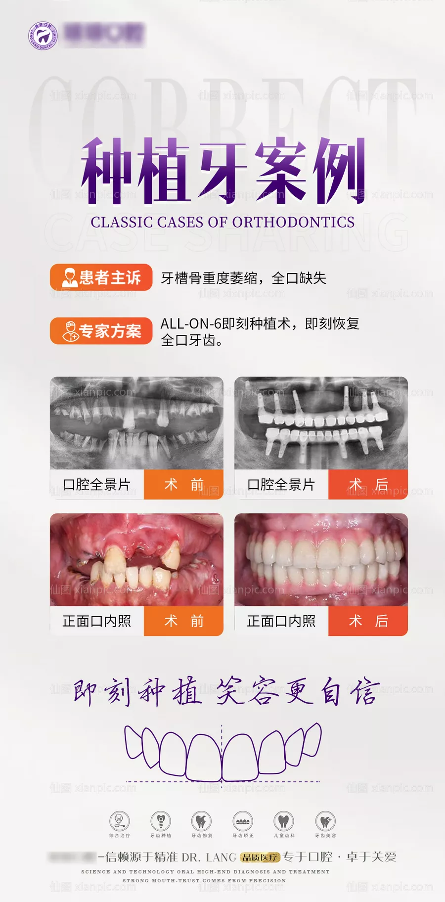 仙图网-口腔种植牙案例对比海报