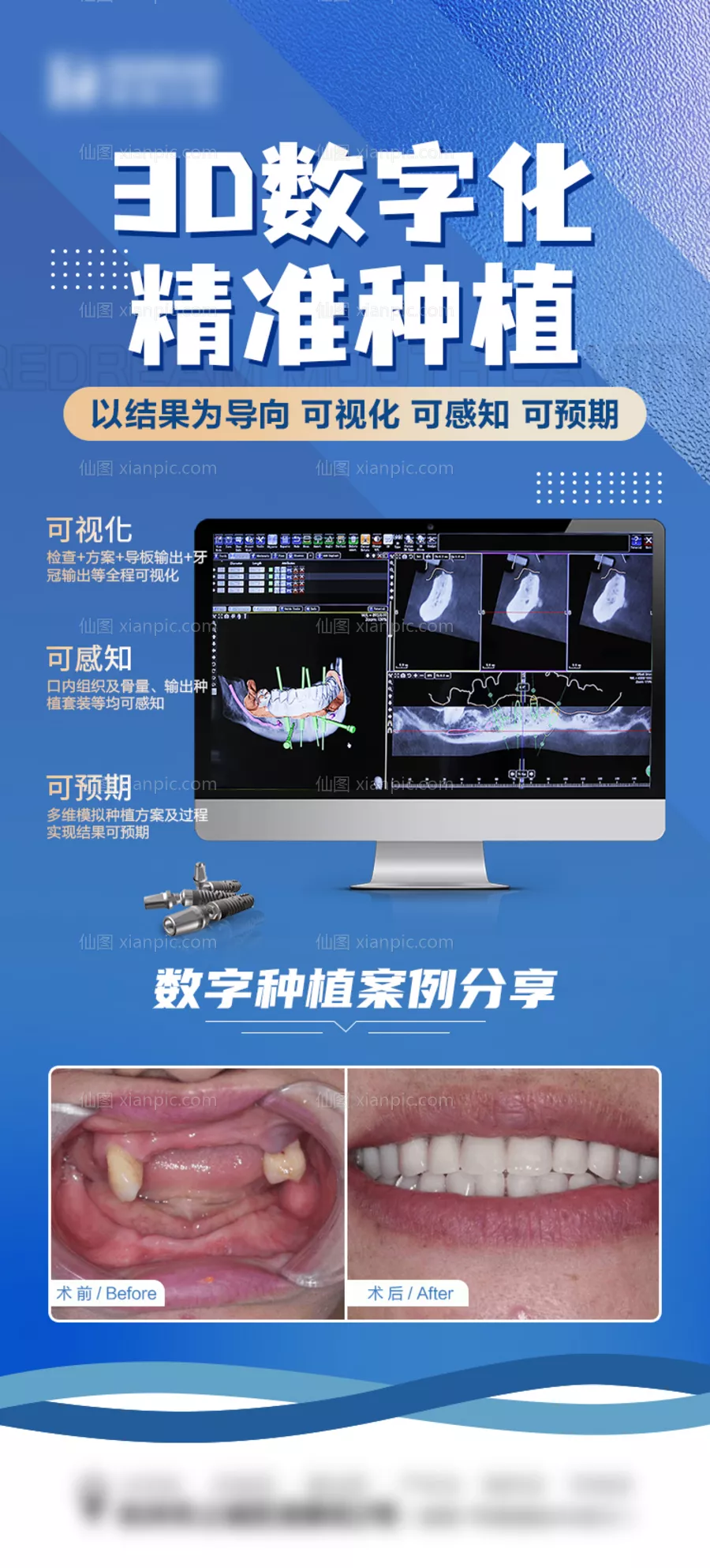 仙图网-数字化种植案例