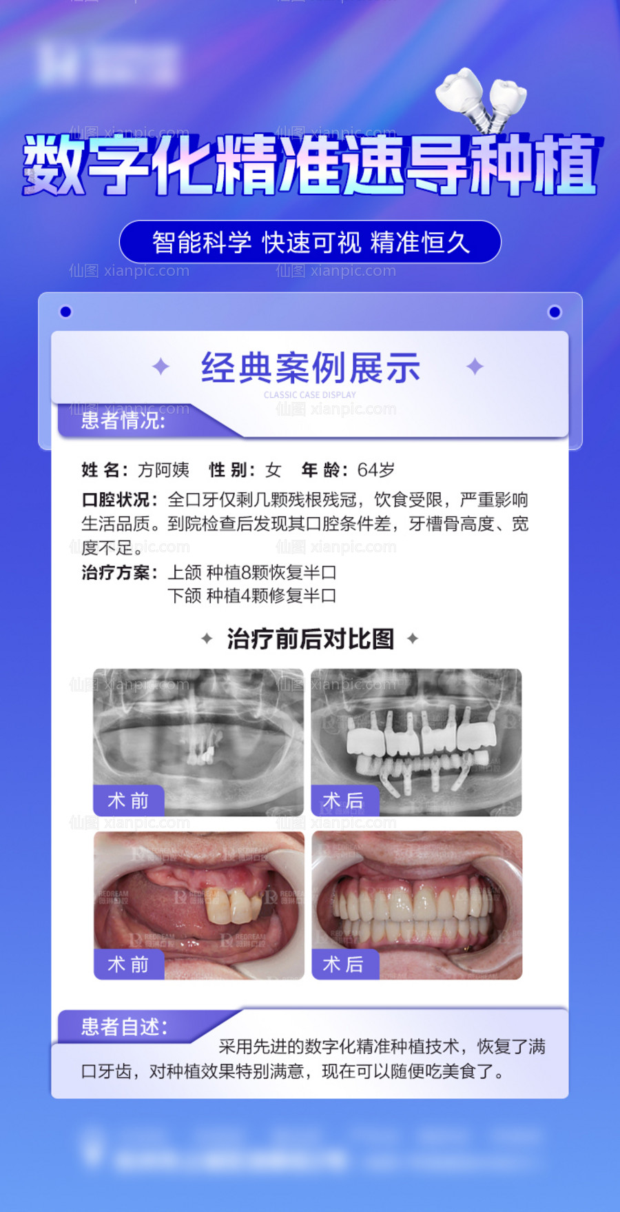 素材乐-口腔案例家口腔海报