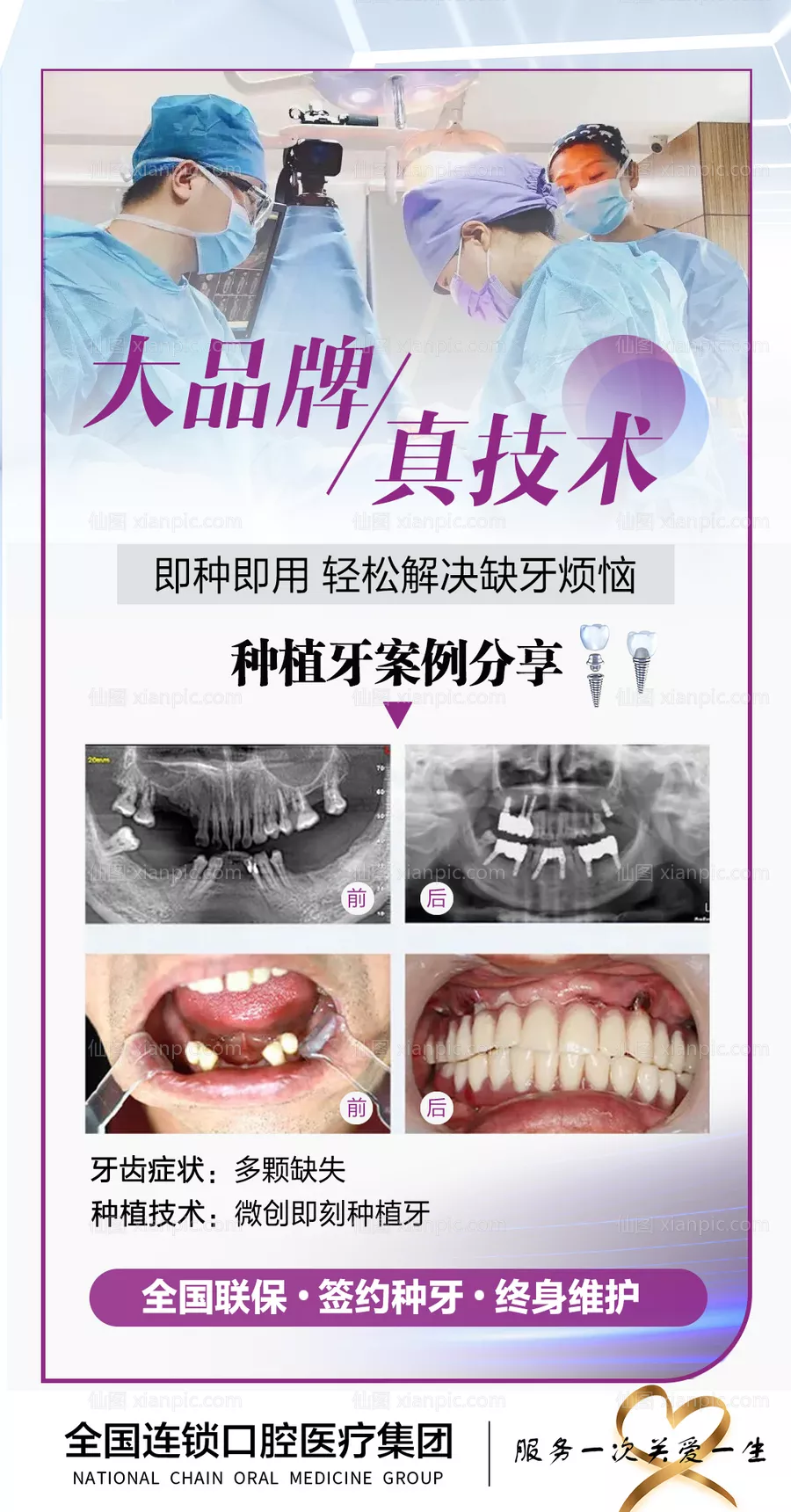 仙图网-种植牙案例