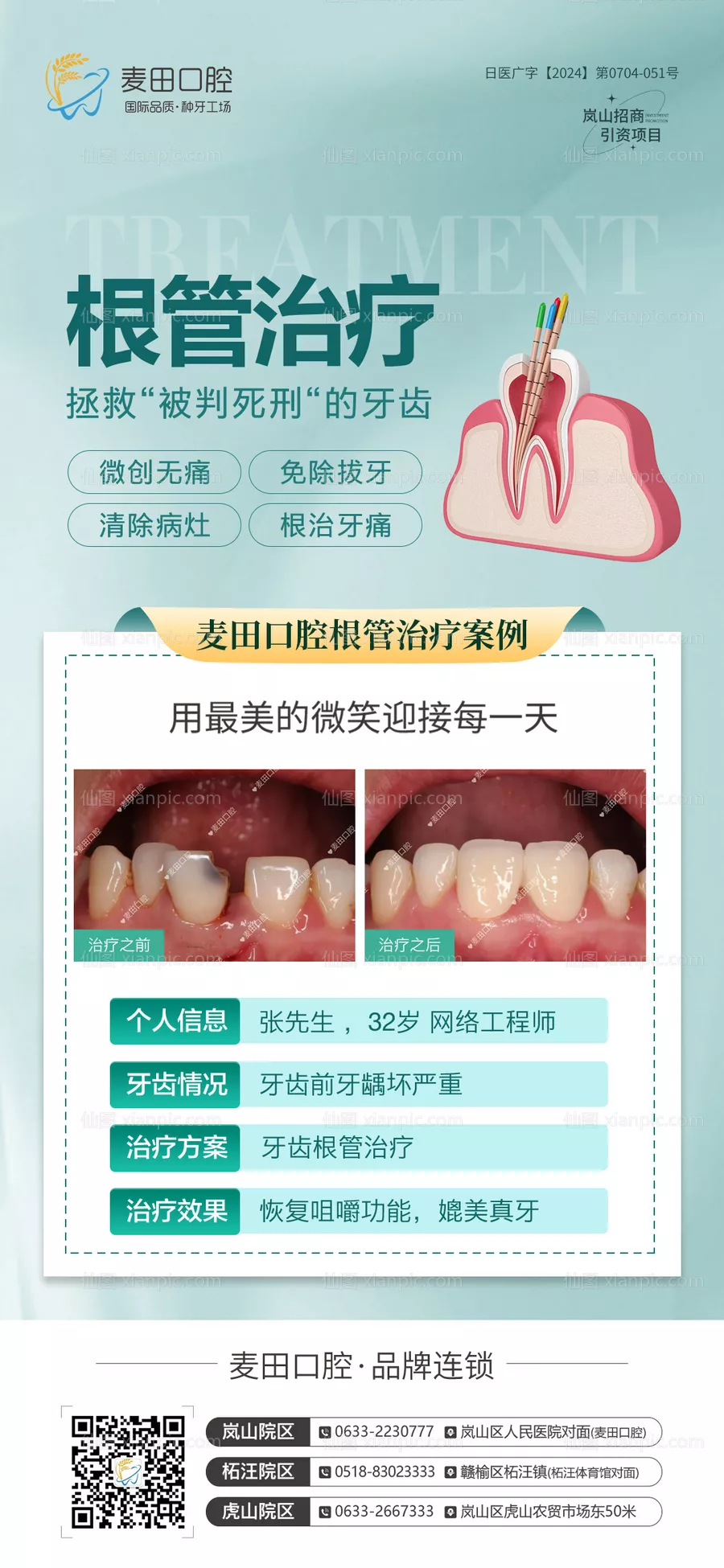 仙图网-医美口腔牙齿根管治疗对比海报