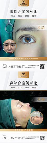 素材乐-医美案例对比图