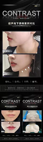 仙图网-整形真人案例对比系列海报