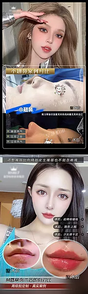 仙图网-医美案例