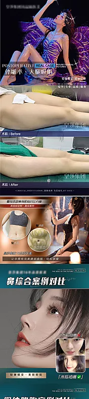 仙图网-医美案例大腿环吸海报