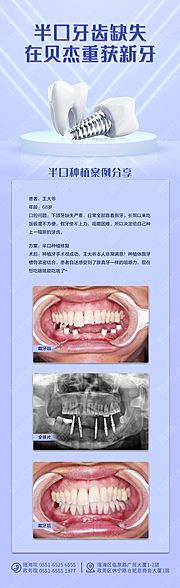 素材乐-半口缺失案例