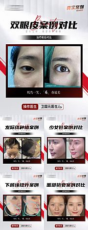 仙图网-医美植发案例合集