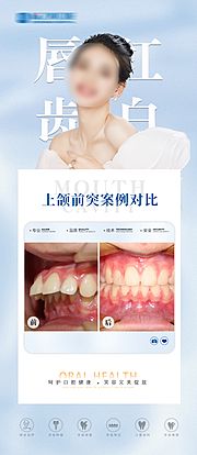 仙图网-上颌前突矫正