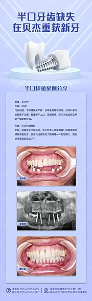 仙图网-口腔半口缺失案例