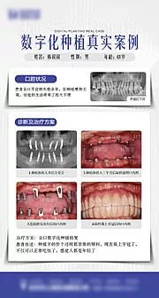 仙图网-数字化种植牙案例