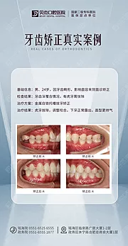 仙图网-牙齿矫正案例