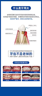 仙图网-牙周炎易拉宝