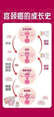 仙图网-宫颈癌的过程