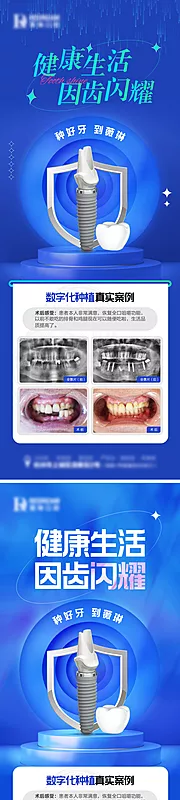 仙图网-种植牙案例