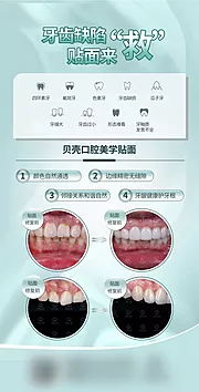 仙图网-牙齿贴面