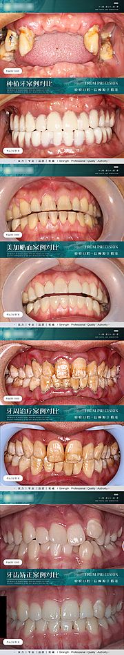 仙图网-口腔案例