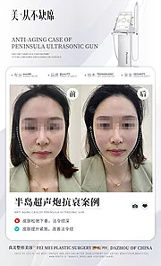 仙图网-医美超声炮案例